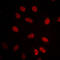 mtHSP70 antibody, LS-B16891, Lifespan Biosciences, Immunofluorescence image 