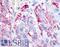 Relaxin Family Peptide Receptor 1 antibody, LS-A565, Lifespan Biosciences, Immunohistochemistry paraffin image 