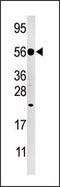 Dual Specificity Phosphatase 8 antibody, AP15269PU-N, Origene, Western Blot image 