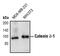 Catenin delta-1 antibody, PA5-17501, Invitrogen Antibodies, Western Blot image 