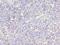 STK38L antibody, A61190-100, Epigentek, Immunohistochemistry paraffin image 