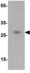 Zinc Finger BED-Type Containing 3 antibody, GTX85295, GeneTex, Western Blot image 