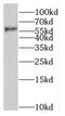 N-Myristoyltransferase 1 antibody, FNab05770, FineTest, Western Blot image 