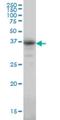 Carbonic Anhydrase 8 antibody, H00000767-M01, Novus Biologicals, Western Blot image 