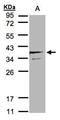 Secretory Carrier Membrane Protein 3 antibody, NBP1-32099, Novus Biologicals, Western Blot image 