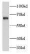 Kinesin-like protein KIFC1 antibody, FNab04573, FineTest, Western Blot image 