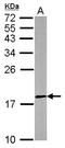 Dual Specificity Phosphatase 26 antibody, LS-C186059, Lifespan Biosciences, Western Blot image 