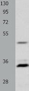 Melanocortin 1 Receptor antibody, TA321478, Origene, Western Blot image 