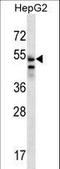 Solute Carrier Family 29 Member 3 antibody, LS-C161206, Lifespan Biosciences, Western Blot image 