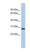 LysM Domain Containing 1 antibody, NBP1-55447, Novus Biologicals, Western Blot image 