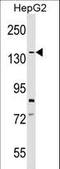 SCP1 antibody, LS-C157119, Lifespan Biosciences, Western Blot image 