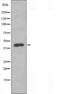 DNA Methyltransferase 3 Beta antibody, orb226011, Biorbyt, Western Blot image 