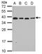 Ribosomal Protein L6 antibody, NBP2-20216, Novus Biologicals, Western Blot image 