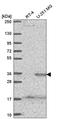 Sprouty RTK Signaling Antagonist 4 antibody, HPA055471, Atlas Antibodies, Western Blot image 