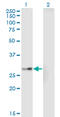 EPH Receptor A7 antibody, LS-C197145, Lifespan Biosciences, Western Blot image 