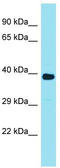 Family With Sequence Similarity 166 Member A antibody, TA336201, Origene, Western Blot image 