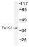 TWIK1 antibody, AP01494PU-N, Origene, Western Blot image 