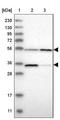 Family With Sequence Similarity 221 Member B antibody, NBP1-90932, Novus Biologicals, Western Blot image 