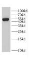CD2 Molecule antibody, FNab01438, FineTest, Western Blot image 