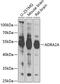 Alpha-2A adrenergic receptor antibody, 15-280, ProSci, Western Blot image 