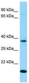 Olfactory Receptor Family 7 Subfamily D Member 4 antibody, TA334339, Origene, Western Blot image 