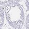 Monoamine Oxidase A antibody, HPA059299, Atlas Antibodies, Immunohistochemistry frozen image 