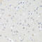 E1A Binding Protein P300 antibody, 14-746, ProSci, Immunohistochemistry frozen image 
