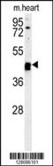 Tubulointerstitial Nephritis Antigen Like 1 antibody, 55-161, ProSci, Western Blot image 