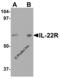 Interleukin 22 Receptor Subunit Alpha 1 antibody, 2497, ProSci Inc, Western Blot image 
