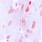 Tyrosine Hydroxylase antibody, LS-C354110, Lifespan Biosciences, Immunohistochemistry frozen image 