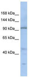 Chromosome 20 Open Reading Frame 194 antibody, TA330593, Origene, Western Blot image 