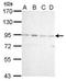 Cold Shock Domain Containing E1 antibody, TA307972, Origene, Western Blot image 
