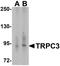 Transient Receptor Potential Cation Channel Subfamily C Member 3 antibody, NBP2-82043, Novus Biologicals, Western Blot image 