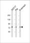 Phospholipase A2 Group IVF antibody, 61-263, ProSci, Western Blot image 