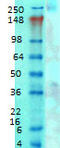 Calcium Voltage-Gated Channel Subunit Alpha1 G antibody, TA326469, Origene, Western Blot image 