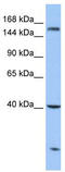 Carboxypeptidase D antibody, TA335872, Origene, Western Blot image 
