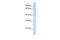 Synapse Defective Rho GTPase Homolog 1 antibody, GTX46973, GeneTex, Western Blot image 