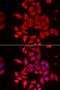 Tropomodulin 4 antibody, orb247622, Biorbyt, Immunocytochemistry image 