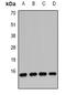 Interferon Alpha Inducible Protein 6 antibody, abx225231, Abbexa, Western Blot image 