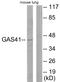 YEATS domain-containing protein 4 antibody, LS-C118738, Lifespan Biosciences, Western Blot image 