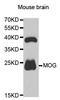 Myelin-oligodendrocyte glycoprotein antibody, TA332631, Origene, Western Blot image 