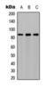 Phosphofructokinase, Muscle antibody, orb393133, Biorbyt, Western Blot image 
