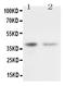 CD82 Molecule antibody, PA1307, Boster Biological Technology, Western Blot image 