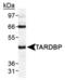 TARDBP antibody, TA301509, Origene, Western Blot image 