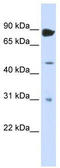 Adenosine Deaminase RNA Specific B1 antibody, TA345763, Origene, Western Blot image 