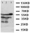 X-Linked Inhibitor Of Apoptosis antibody, LS-C312670, Lifespan Biosciences, Western Blot image 