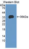 p68 antibody, LS-C728561, Lifespan Biosciences, Western Blot image 