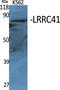 Leucine Rich Repeat Containing 41 antibody, GTX34065, GeneTex, Western Blot image 