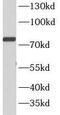 Signal Transducer And Activator Of Transcription 4 antibody, FNab08302, FineTest, Western Blot image 
