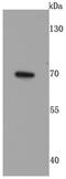 Glutamate Decarboxylase 2 antibody, NBP2-66855, Novus Biologicals, Western Blot image 